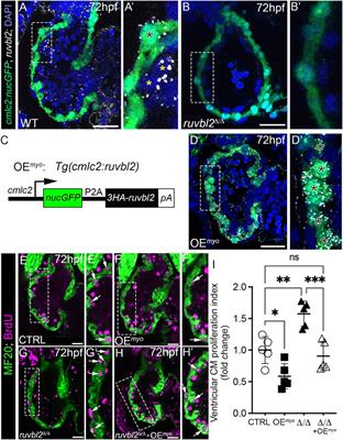 Ruvbl2 Suppresses Cardiomyocyte Proliferation During Zebrafish Heart Development and Regeneration